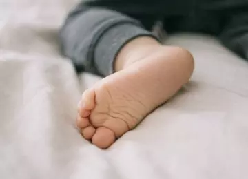 Bébé et pied bot : tout ce que vous devez savoir