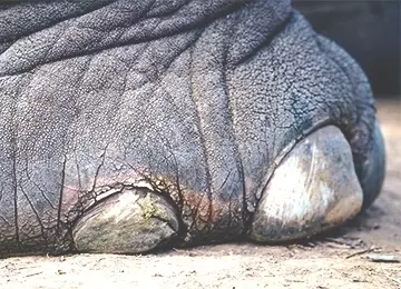 Avis d’expert | Les principales causes des callosités aux pieds