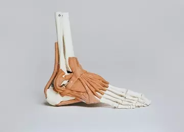Avis d’expert | Tout savoir sur la fasciite plantaire