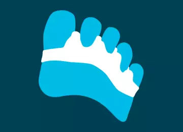 Orthoplastie : une orthèse pour les orteils