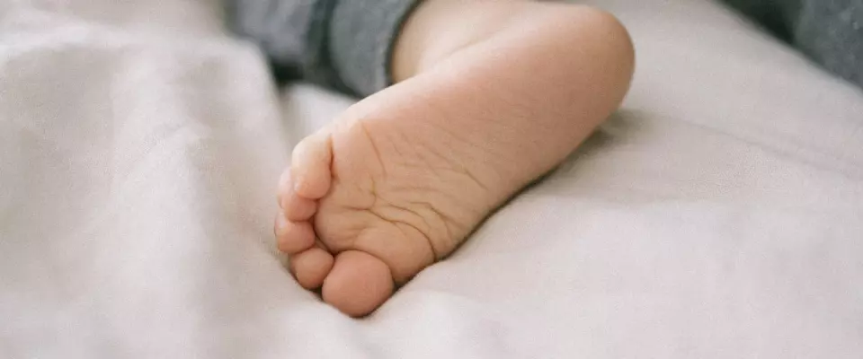 Bébé et pied bot : tout ce que vous devez savoir