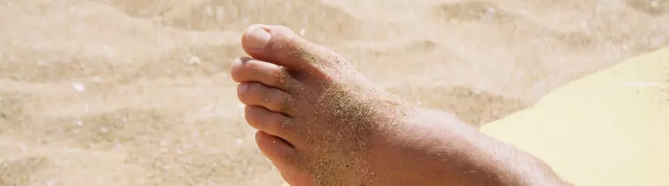 6 exercices pour éviter que l’hallux valgus ne s’aggrave