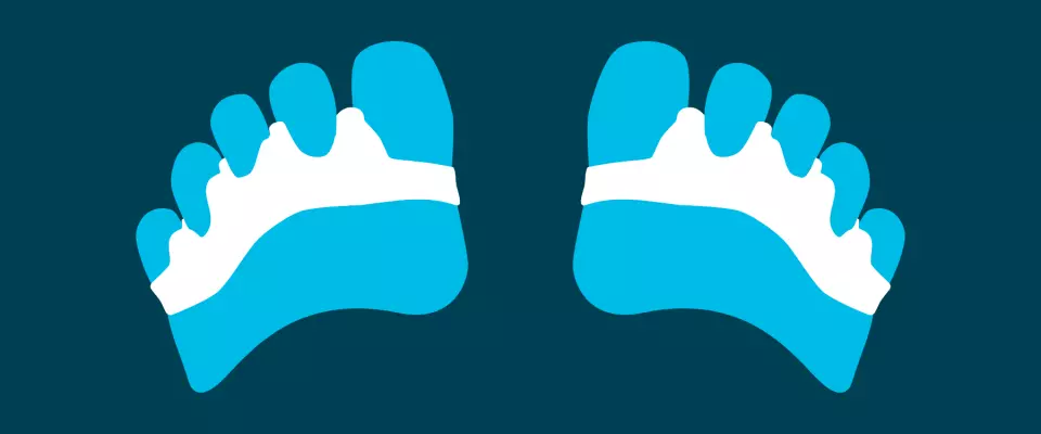 Orthoplastie : une orthèse pour les orteils